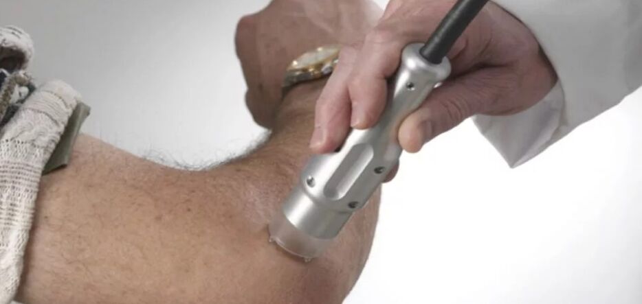 Psoriasis treatment with a laser